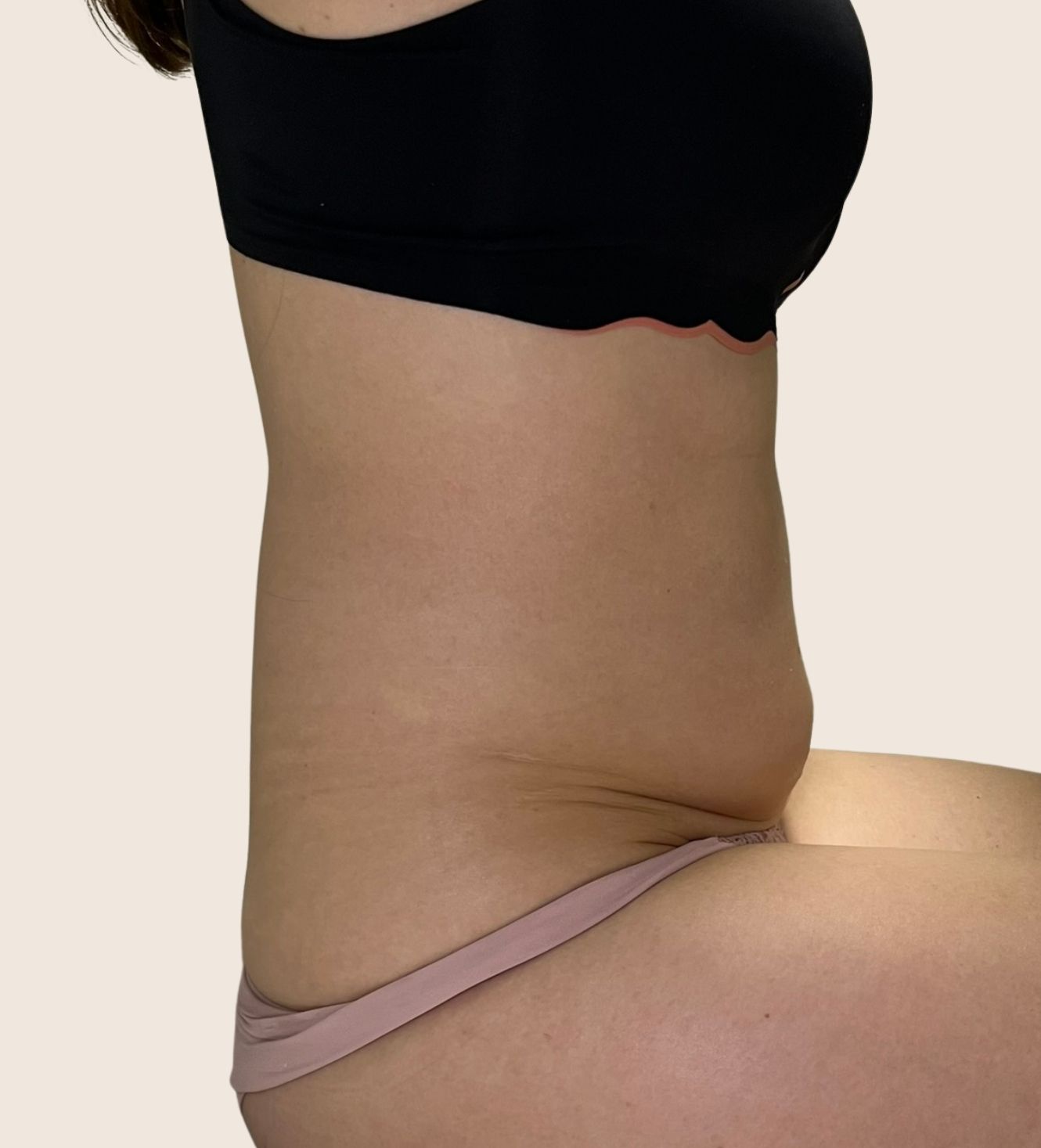 tratamentos-corporais-curitiba-ana-fonseca-derma-contour.jpeg (2)