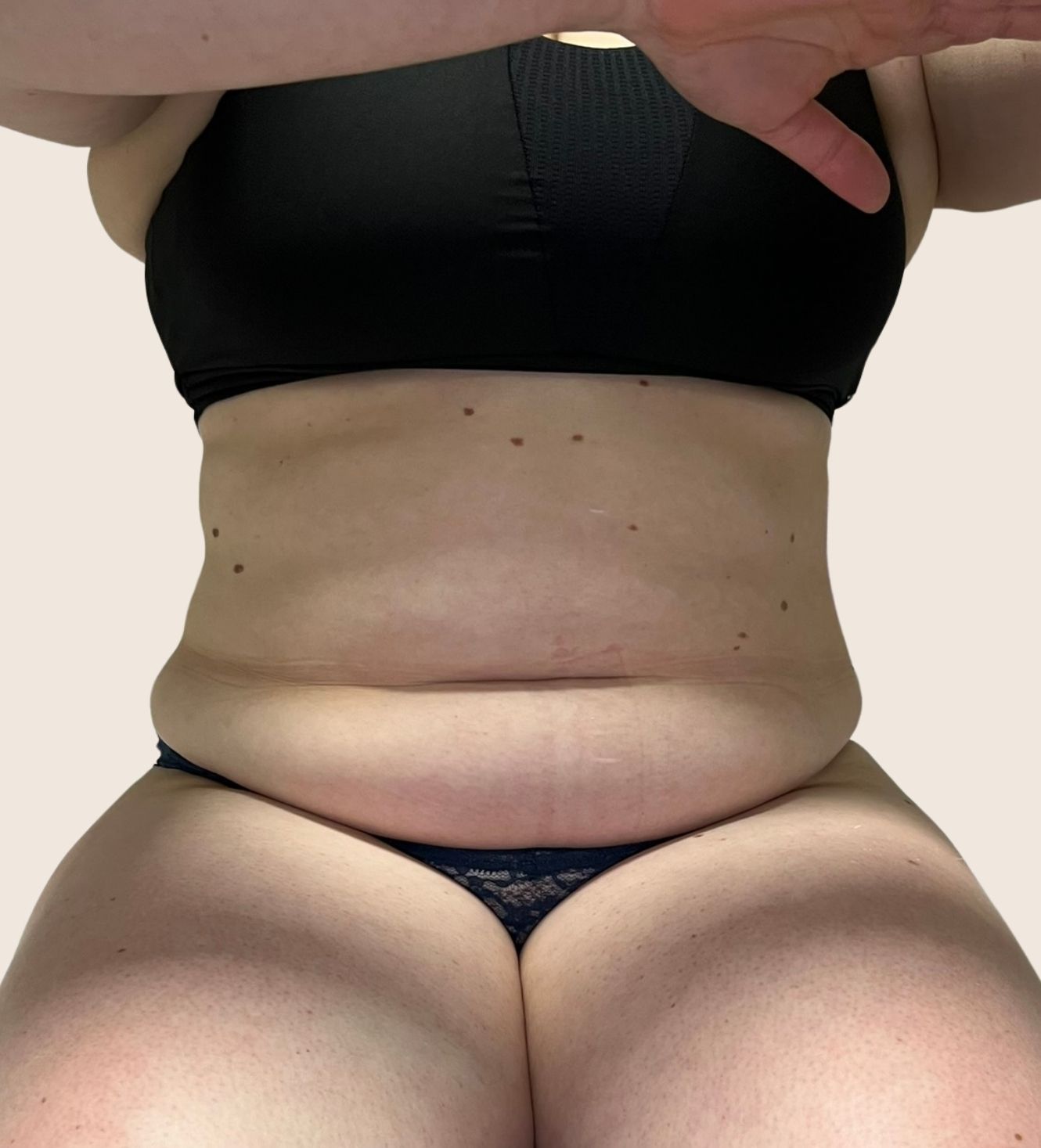 tratamentos-corporais-curitiba-ana-fonseca-derma-contour.jpeg (3)