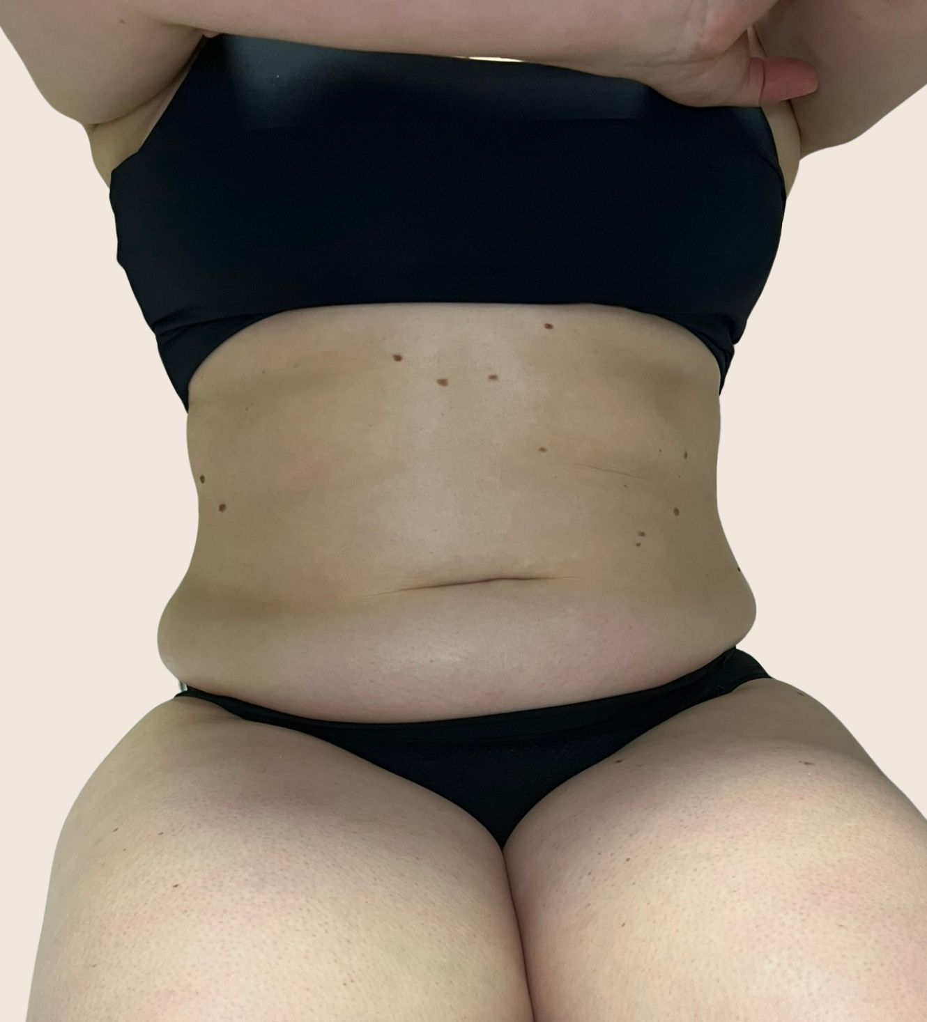 tratamentos-corporais-curitiba-ana-fonseca-derma-contour.jpeg (4)