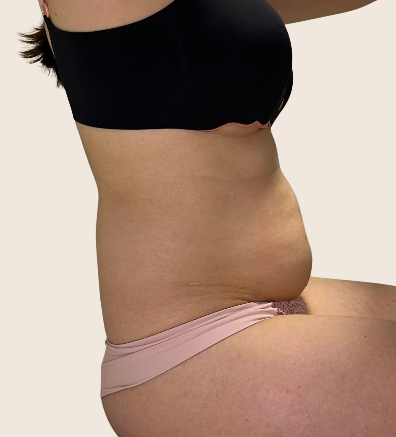 tratamentos-corporais-curitiba-ana-fonseca-derma-contour.jpeg