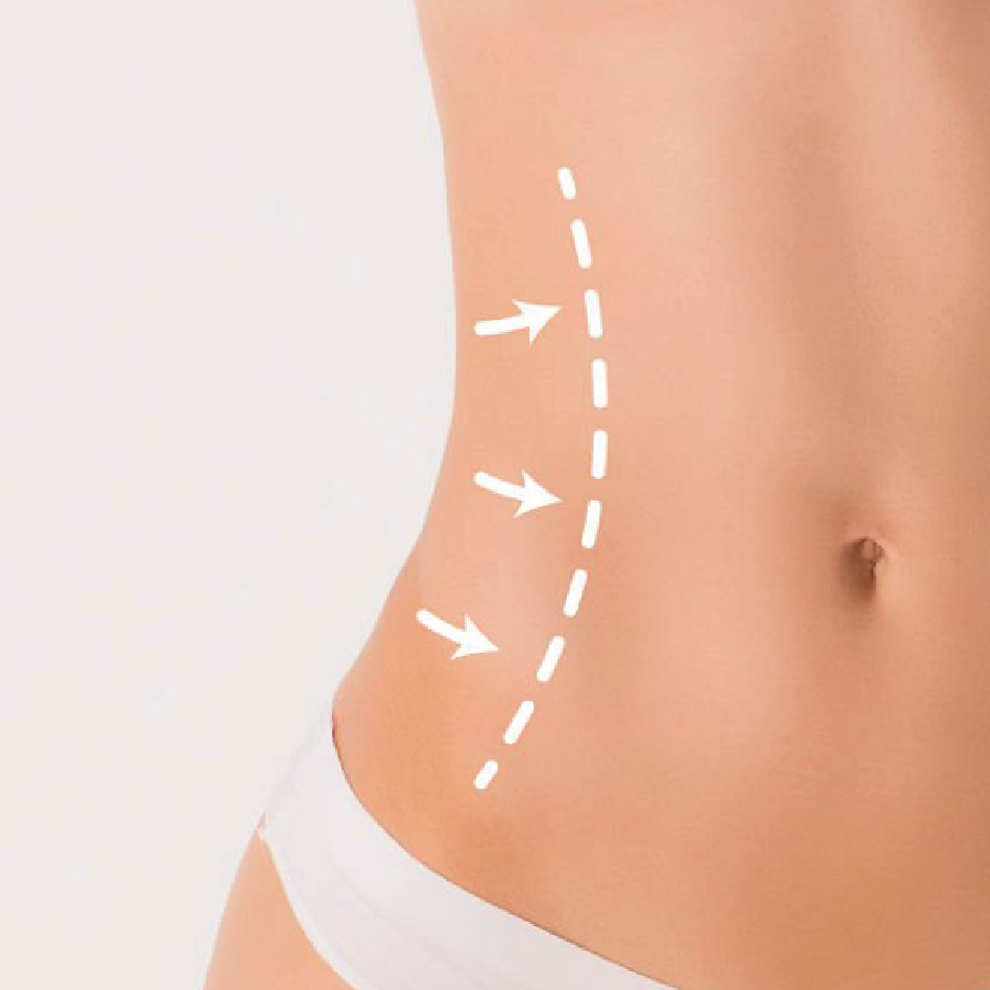 Melhorar-contorno-corporal-tratamento-curitiba-reducao-de-medidas-emagrecimento-capa