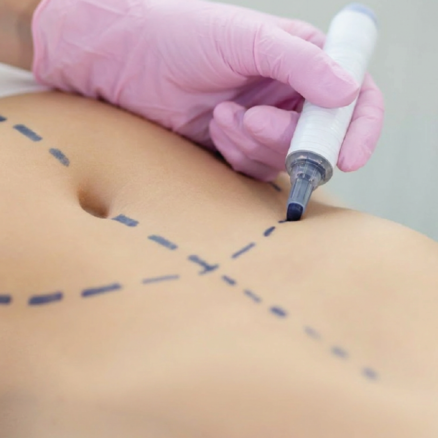 Tratamento-para-flacidez-barriga-pernas-corpo-corporal-curitiba-capa -pequena